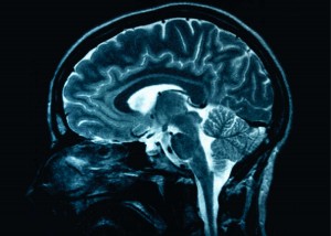 Mind Muscle Connection: Enhance training!